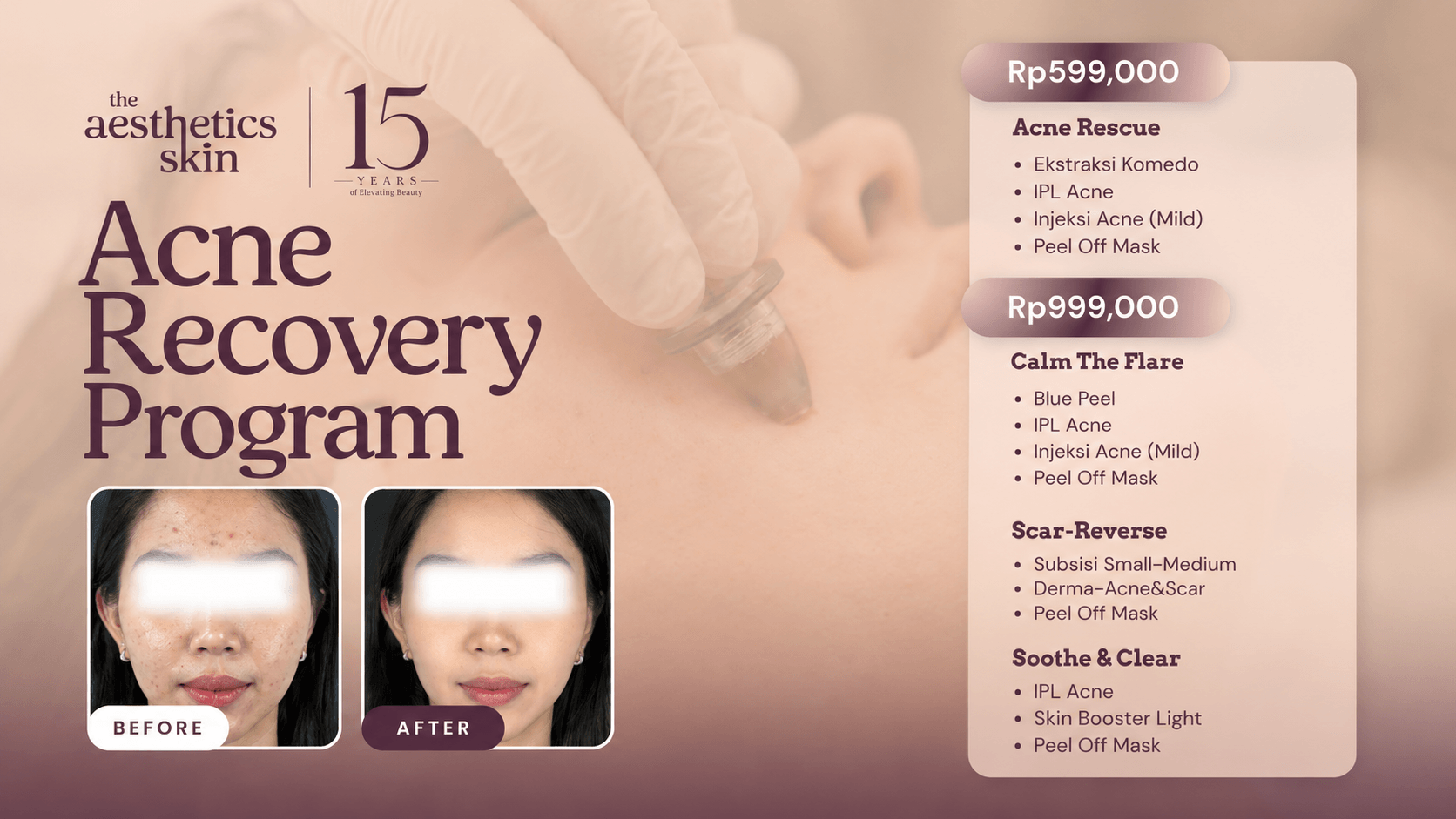 Acne Recovery Program The Aesthetics Skin